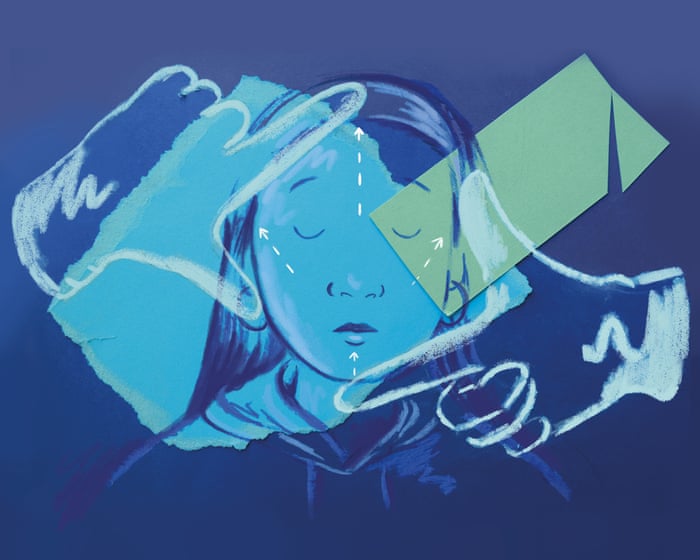 Why young women are having facelifts: ‘I couldn’t even open my eyes. That’s how swollen I was’